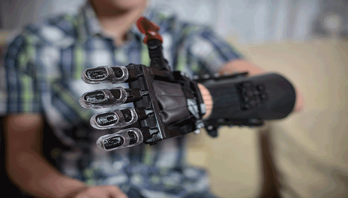 Bionic hand